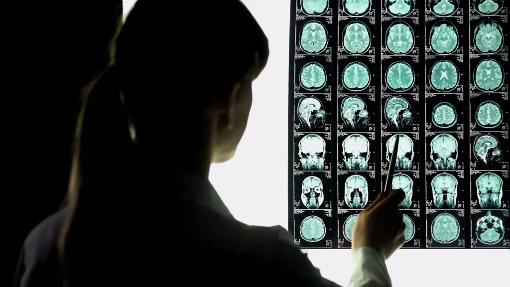 Doctor analyzing brain MRI scans for neurologist mailing list insights