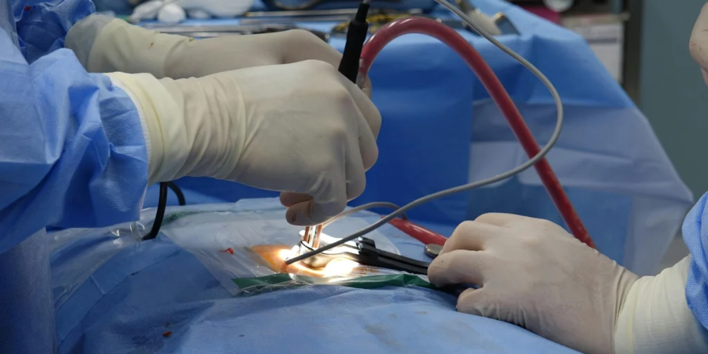 How ResearchCaptive Builds Reliable Surgeon Contact Lists